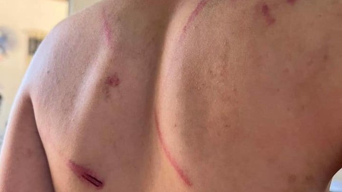 Đắk Lắk: Cháu bé 9 tuổi bị bà và bố đánh đập dã man