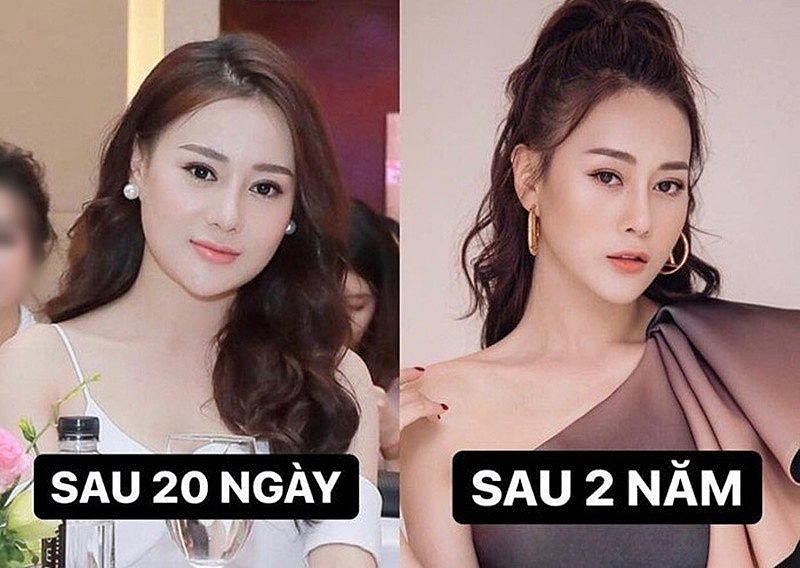 Netizen 'đào lại' nhan sắc thời chưa nổi tiếng của Phương Oanh