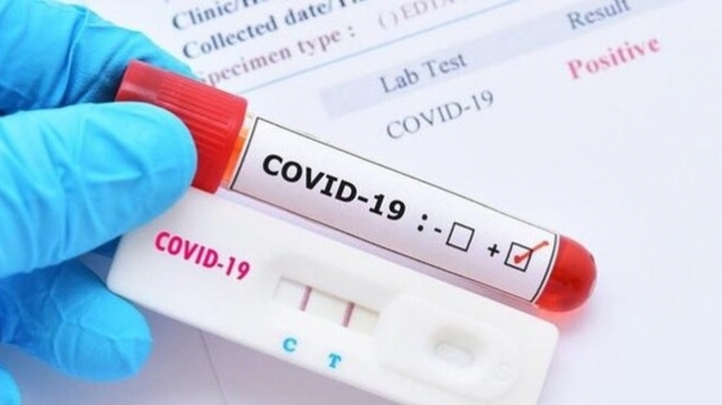 Chuyên gia chỉ ra sai lầm nghiêm trọng khi sử dụng test nhanh Covid-19