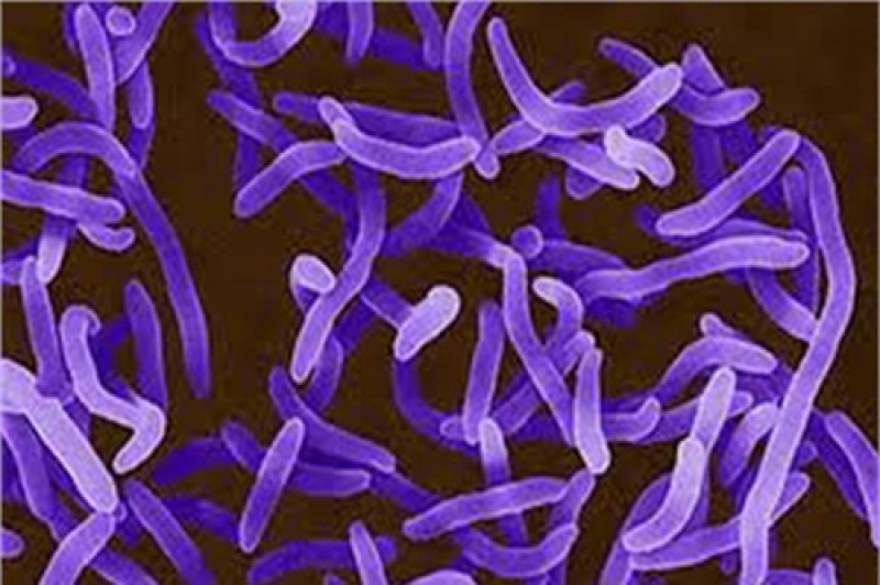 Vi khuẩn Corynebacterium diphtheria gây bệnh bạch hầu dưới kính hiển vi.