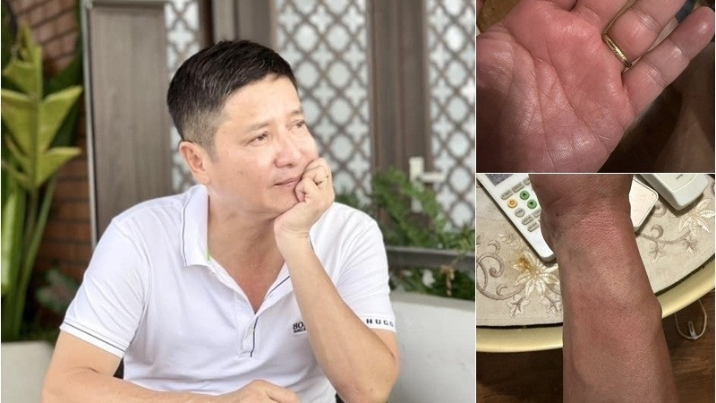 NSƯT Chí Trung và hành trình 6 tháng tìm ra nguyên nhân căn bệnh gây mất ngủ triền miên