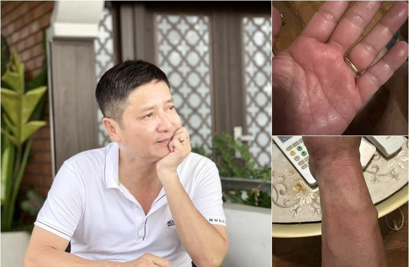 NSƯT Chí Trung và hành trình 6 tháng tìm ra nguyên nhân căn bệnh gây mất ngủ triền miên