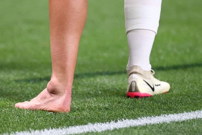 Cầu thủ Tây Ban Nha chấn thương kinh hoàng, cổ chân bị bẻ gập