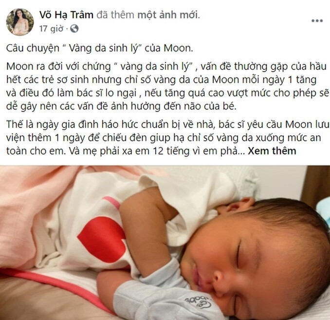 Con gái Võ Hạ Trâm mắc bệnh mà nhiều trẻ hay gặp, nguy hiểm cỡ nào mà khiến cô như 'ngồi trên lửa'?