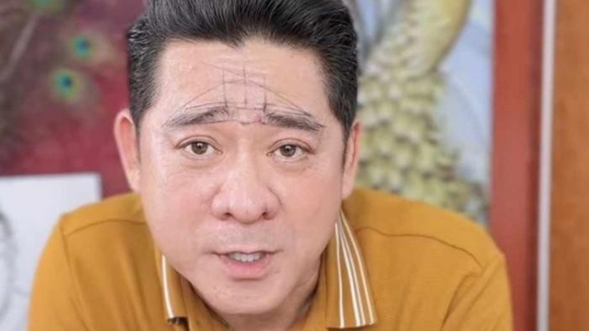 Diễn viên Huỳnh Anh Tuấn U60 công khai "tân trang" vẻ ngoài, kết quả ra sao so với MC Thanh Bạch?