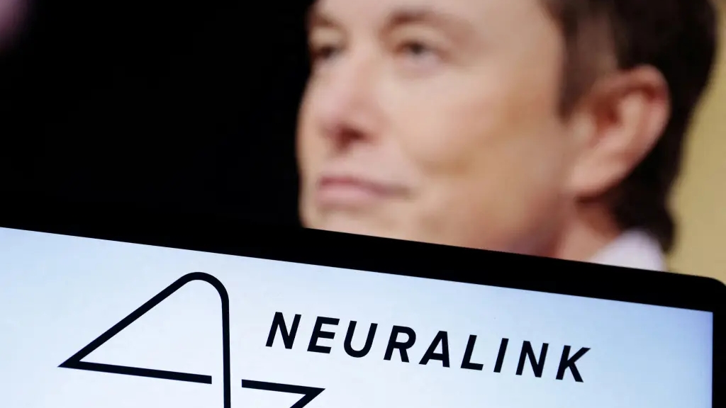 Startup cấy chip não của Elon Musk được phép nghiên cứu trên người